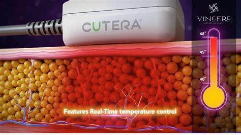 trusculpt id singapore|TruSculpt iD Singapore .